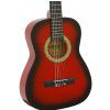 Martinez MTC 082 Pack Red Sunburst klasick gitara